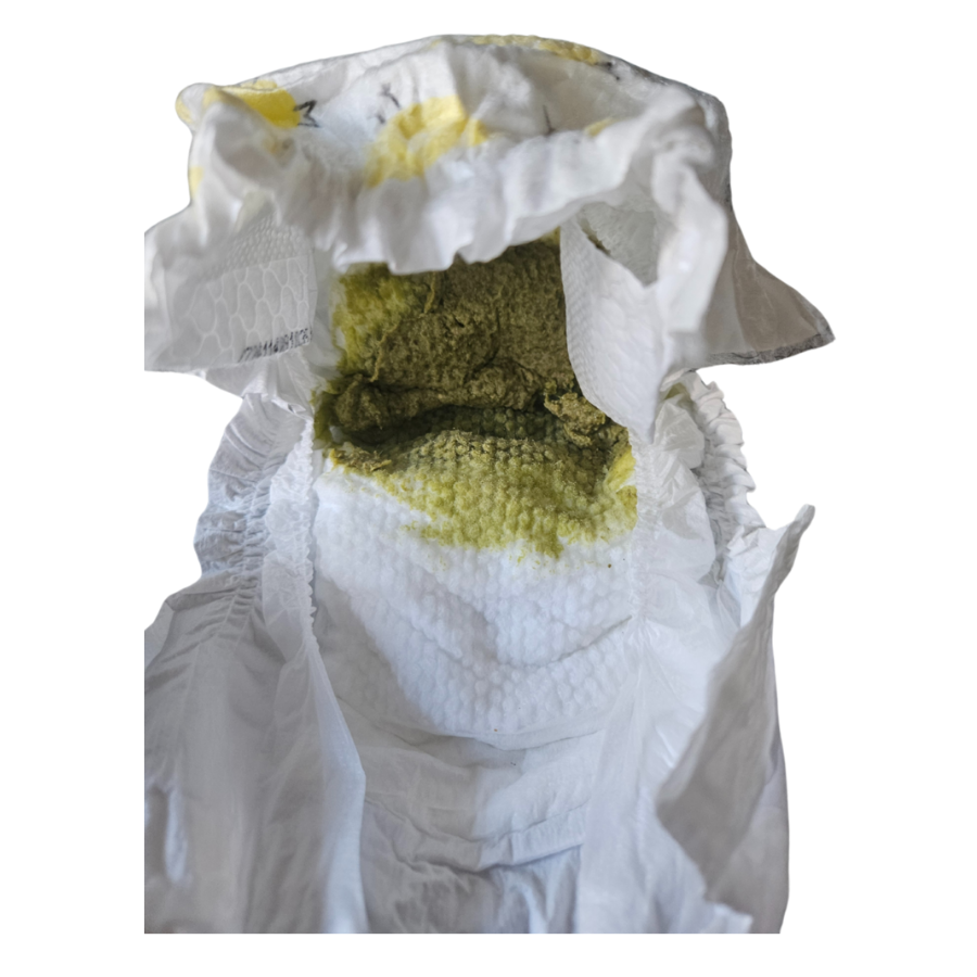 An open nappy with green poo inside. 