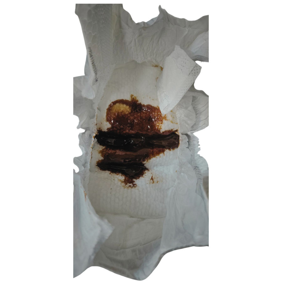 An open nappy with a brown poo inside.  