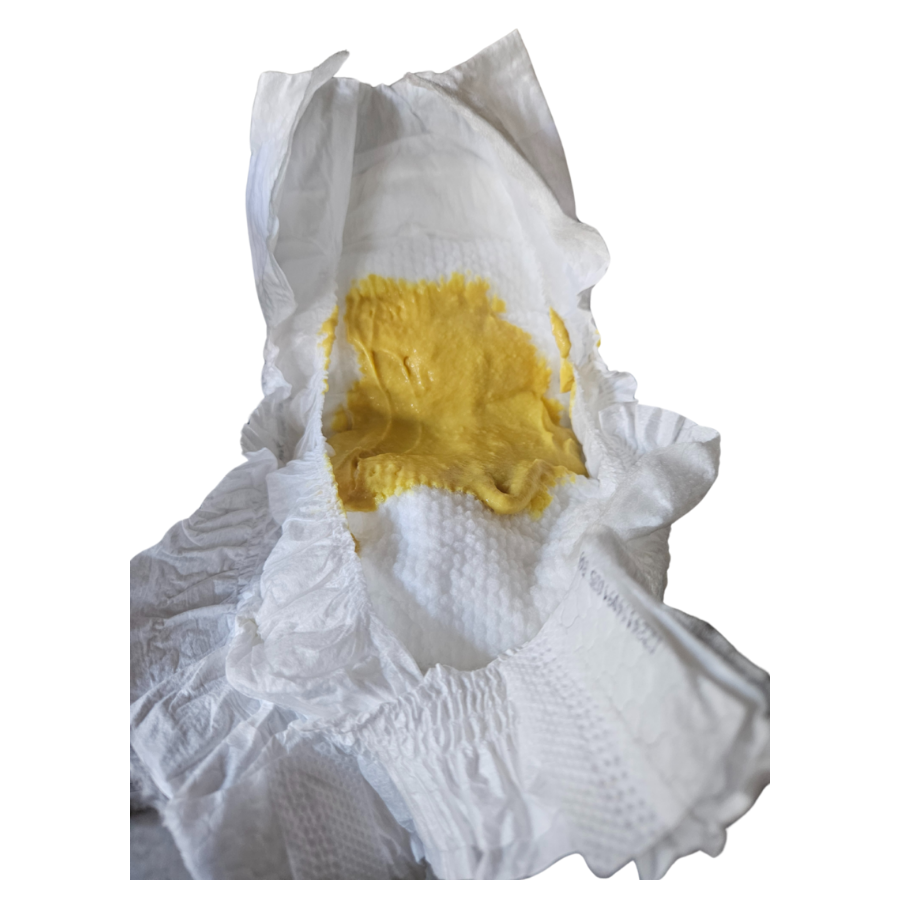 An open nappy with a mustard yellow colour poo inside. The poo is very soft and almost in liquid form.